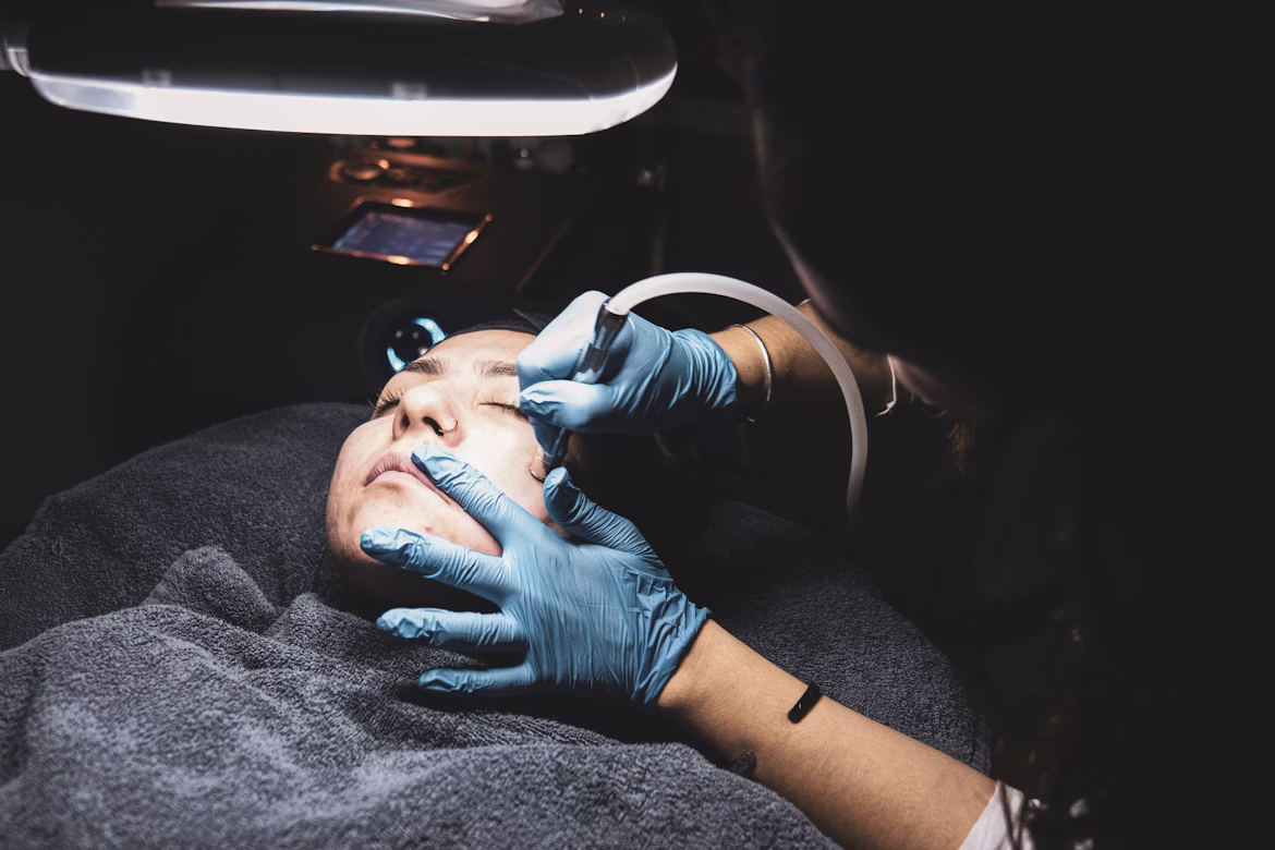 Microneedling